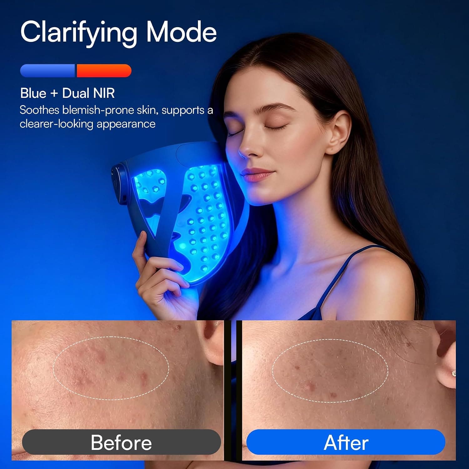 INIA GLOW 4D Wireless Red Light Therapy Mask for Face, Dual NIR, 320 LEDs — photo 5